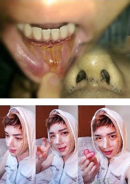 组图:揭秘韩国大叔变美男过程 辛酸整容史爆红网络